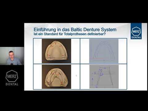 Webinar: Baltic Denture System Teil 1 - Was ist BDS? | #BalticDentureSystem
