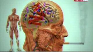 SONA: Ilang gulay tulad ng cauliflower at patatas, may taglay na nicotine, ayon sa isang pag-aaral