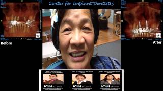 Dental Implant Center San Jose CA - Center for Implant Dentistry - Patient Testimonial