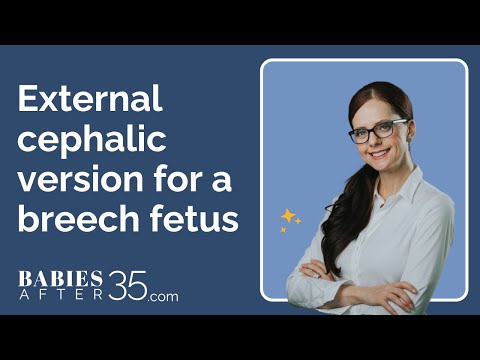 External cephalic version for a breech fetus