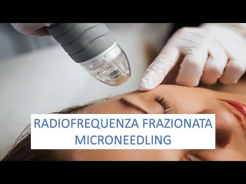 RADIOFREQUENZA FRAZIONATA MICRONEEDLING PER IL LIFTING NON CHIRURGICO