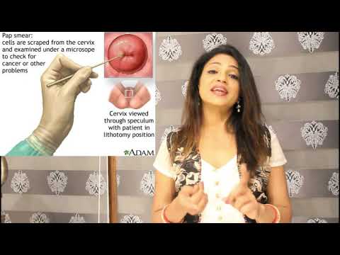 Menstrual Irregularities and Its Causes- Part 2