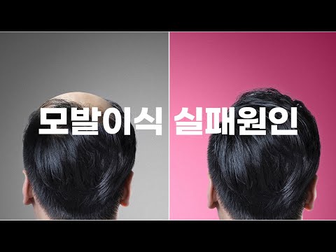 모발이식 실패하는 원인이 뭘까?