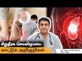 Kidney Failure Symptoms In Tamil Warning Signs And Symptoms Of Kidney Disease Salem Gopi Hospital