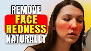 Best Rosacea Treatment | How to Get Rid of Redness on Face