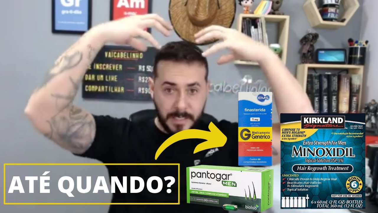 TRANSPLANTE CAPILAR - ATÉ QUANDO PRECISO FAZER USO DE MEDICAMENTOS (MINOXIDIL E POLIVITAMÍNICOS)