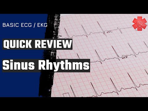 Sinus Rhythms: What You Need to Know