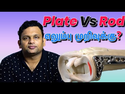 Which Implant is better for fracture Rod or Plate? Dr. Shriram Krishnamoorthy | Tamil
