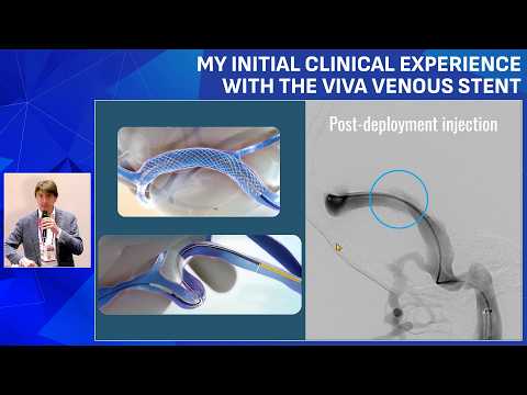 Vflow Symposium - Viva Stent feasibility study