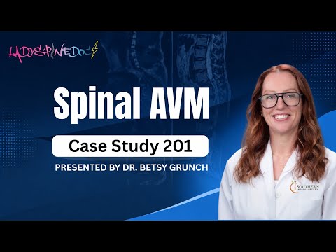 Case Study 201 Spinal Avm Explained By Dr Betsy Grunch