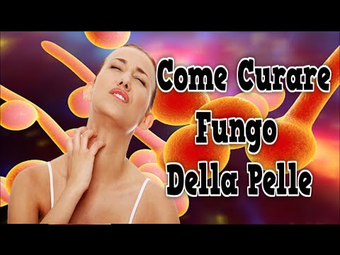Come distruggere lentiggini da una faccia Se è possibile usare creme di decolorazione in tempo