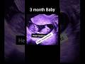 3 months pregnancy ultrasound baby movements 🥰🥰🥰|#viral #trending