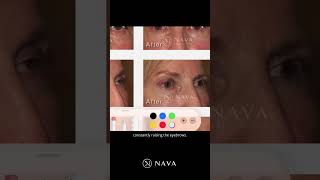 Nava Face & Eye