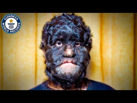 The World's Hairiest Family | Records Weekly - Guinness World Records