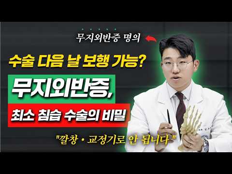 헬스조선명의 - 최소침습술로 '무지외반증' 쉽고 빠르게 완치
