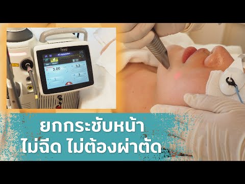 ร้อยไหม