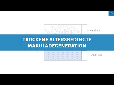 Trockene Altersbedingte Makuladegeneration - Trockene AMD - Erklärvideo