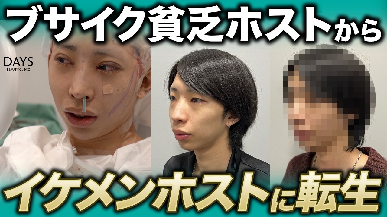 売上ゼロのホストが最後にかけた望みは整形だった。全顔整形を受けて転生したホストの2ヶ月後がマジでエグすぎた...