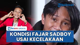 Fajar Sadboy Alami Kecelakaan Motor, Amanda Manopo Sebut Kondisinya Serius dan Memprihatinkan