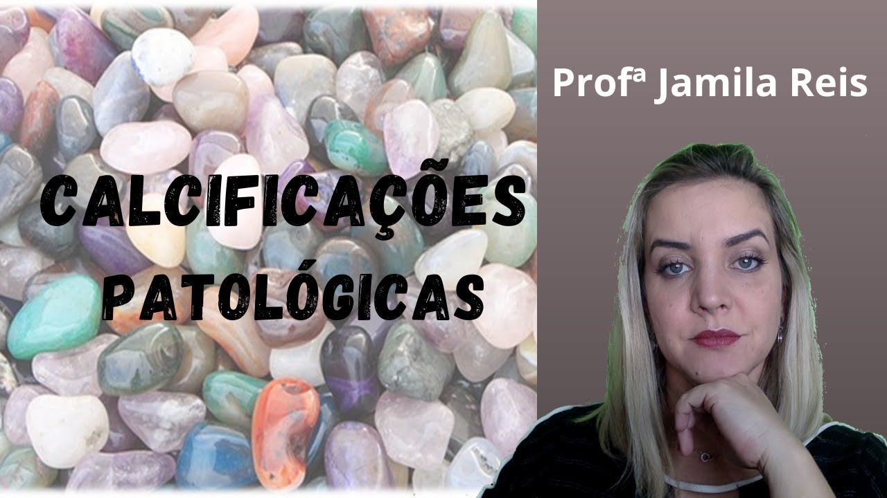 Calcificações patológicas