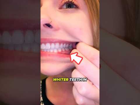 The Secret to Whiter Teeth in 20 Seconds!