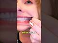 The Secret To Whiter Teeth In 20 Seconds