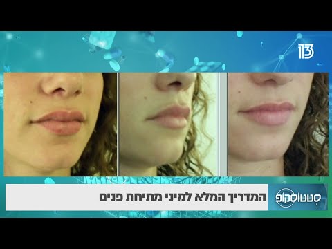 המדריך המלא למיני מתיחת פנים