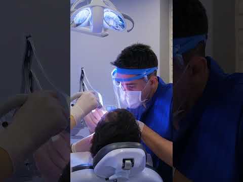 Comprehensive Guide to the Full Mouth Dental Implants Procedure in Istanbul, Turkey