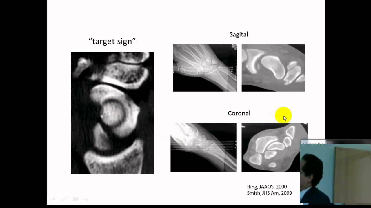 Ranulfo Romo Rodríguez-9