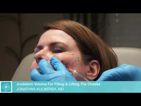 Juvéderm Voluma for Cheeks | Charlotte Facial Plastic Surgeon