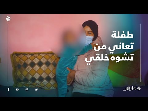 نعمة" طفلة تعاني من تشوه خلقي في الجهاز التناسلي.. الأم بالدموع عاونوني على بنيتي مابغيتهاش تلومني"