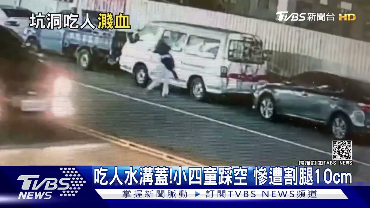 吃人水溝蓋!小四學童踩空 慘遭割腿10cm