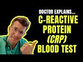 Arzt Erklärt Bluttest Auf C Reaktives Protein CRP