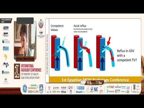 Ultrasound Examination of Superficial Leg Veins