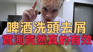 啤酒洗頭去頭皮屑？實測竟然真的有效！