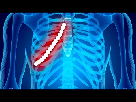 What Would Happen If You Swallowed a Magnet by Accident