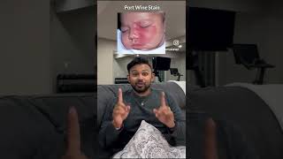 Download lagu Neurocutaneous Syndromes for the USMLE | HyGuru mp3