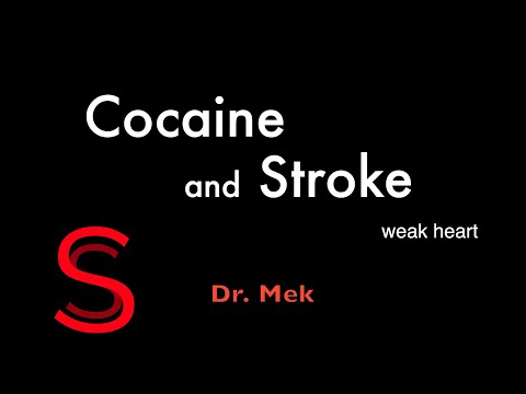 Strike Stroke with Dr. Mek: Cocaine and Stroke. (E20) #stroke #cocaine