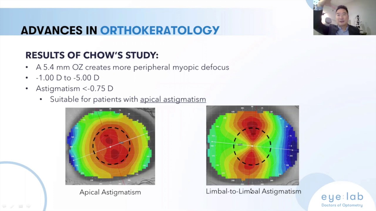 New Advances in Myopia Management