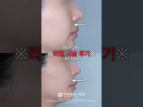 땡큐성형외과 Clips