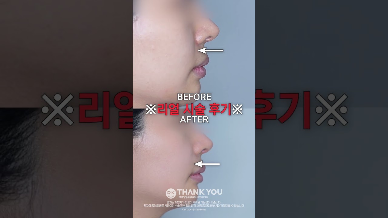 땡큐성형외과 Clips