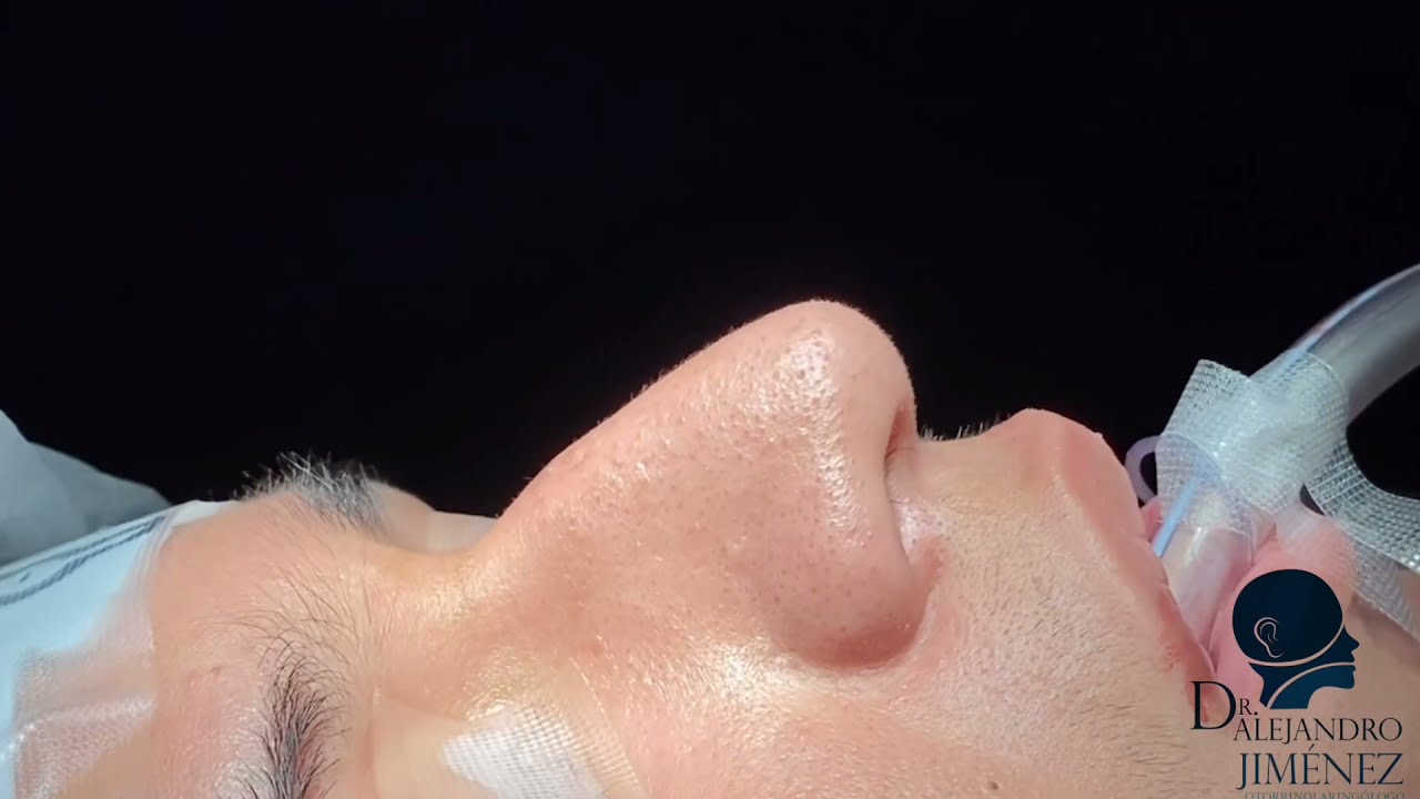 Alejandro Jimenez Garcia-59