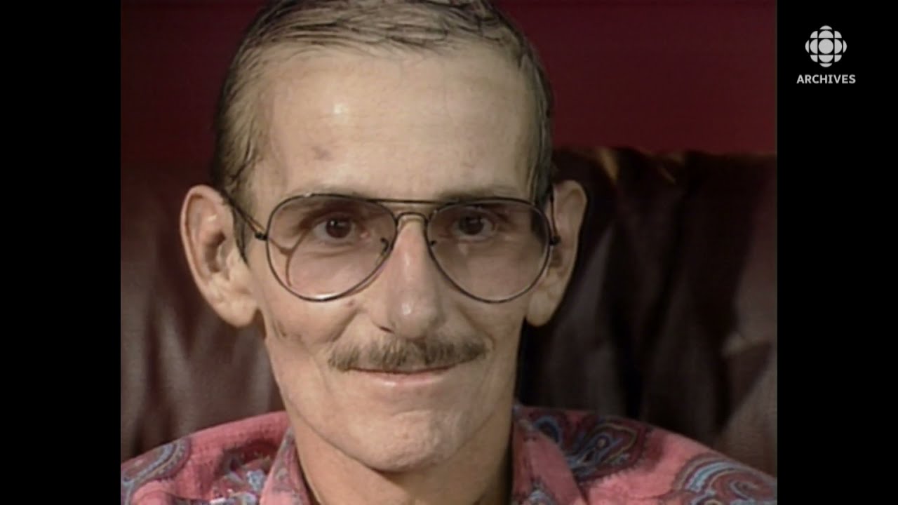 En 1986, témoignage émouvant d'un homme qui a contracté le virus du sida