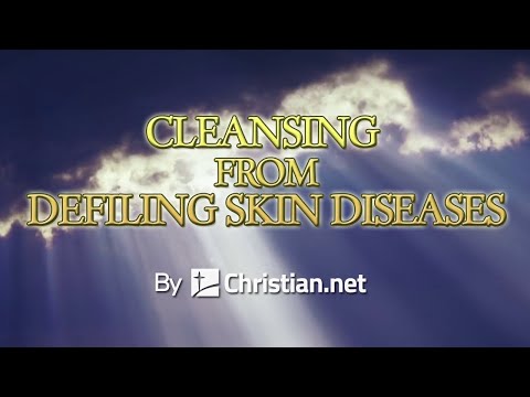 Leviticus 14:1 – 32: Cleansing From Defiling Skin Diseases | Bible Stories