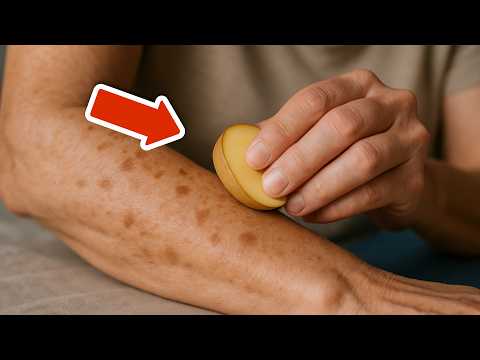 Wipe away age spots in 20 minutes with a potato💥(Super easy)🤯