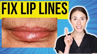 Top Tips To Fix Lip Lines
