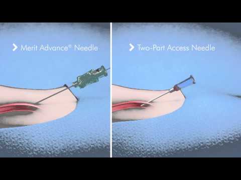 Introducer Sheath