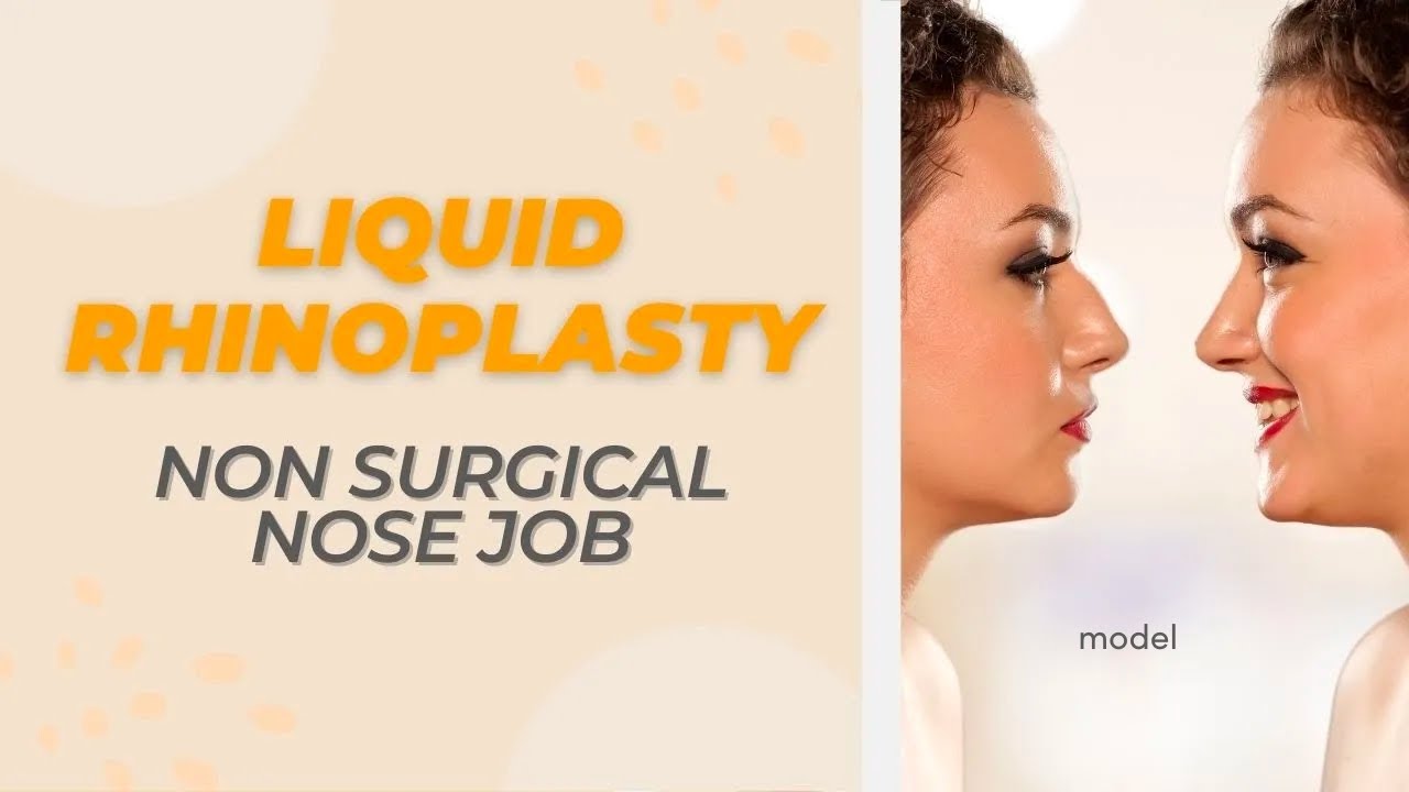Liquid Rhinoplasty: The Non-Surgical Nose Job  [Part 3 of #RiedlerKnowsNoses]