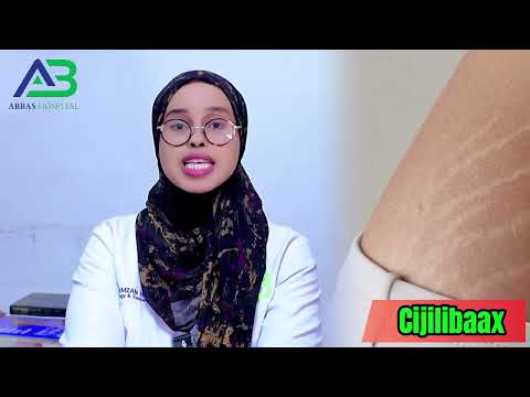 Waaa maxay jeex jeexitaan?