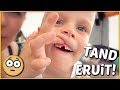 LUAN HEEFT ZiJN TAND ERUiT! ? | Bellinga Familie Vloggers #1396